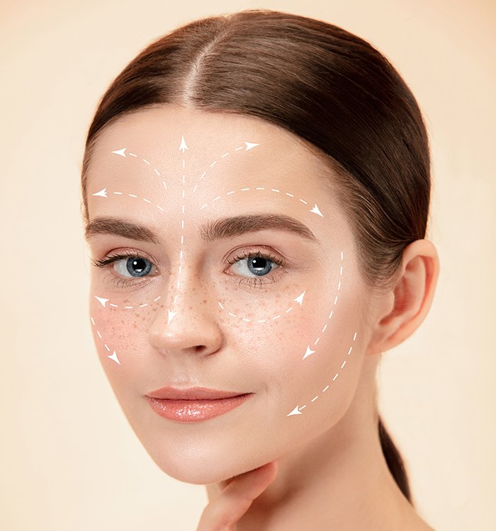 Thread lift treatment at SnB Aesthetic Clinic