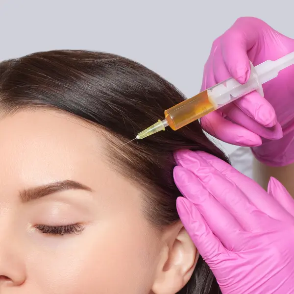 Hair Loss Treatment Dubai at SnB Aesthetic Clinic UAE