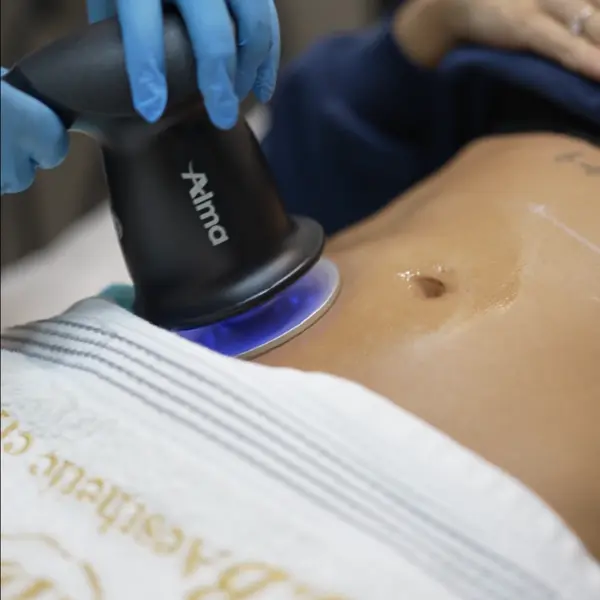 Alma PrimeX in Dubai, Body Contouring SnB Aesthetic Clinic Dubai | Fat Reduction & Skin Tightening