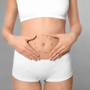 Best Mommy makeover in Dubai at SnB Aesthetic Clinic, Jumeirah, Al Wasl Road, UAE