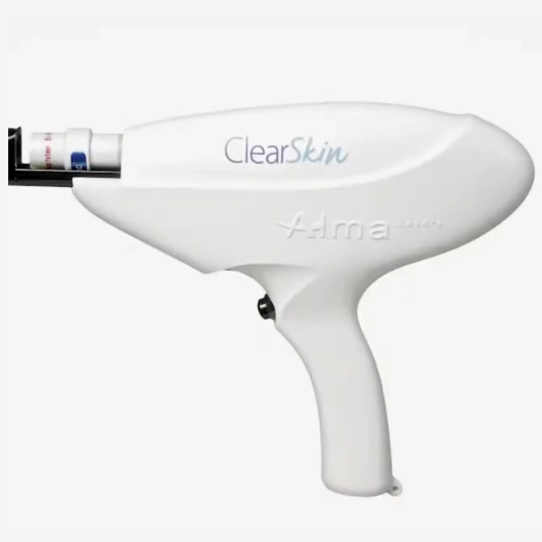 Laser Acne Treatment in Dubai- Alma Clear Skin Treatment for Acne