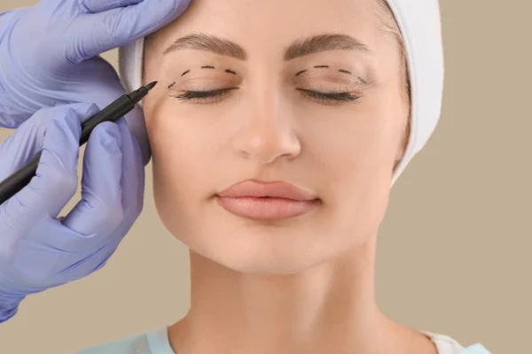 Blepharoplasty in Dubai at SnB Aesthetic Clinic Dubai