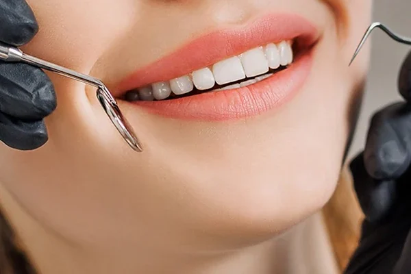 Smile makeover Dubai- Smile care Dubai Dental Clinic, Al Wasl Road