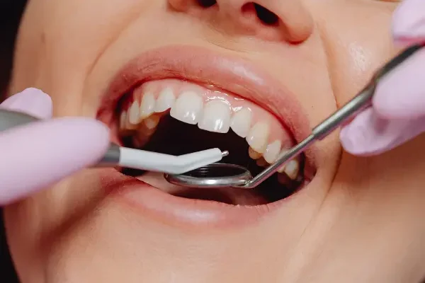 Straumann dental implants Dubai- Dental Clinic Dubai