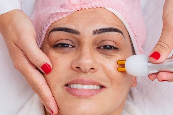Melasma Treatment in Dubai, UAE. Best pigmentation treatment Dubai