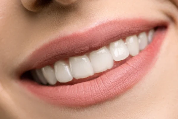 Best Teeth whitening in Dubai Dental Clinic-Teeth bleaching in dubai dental clinic, UAE