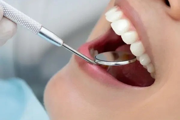 Best Tooth Extraction in Dubai, Emergency Tooth removal, Wisdom tooth removal, Al Wasl Road, UAE